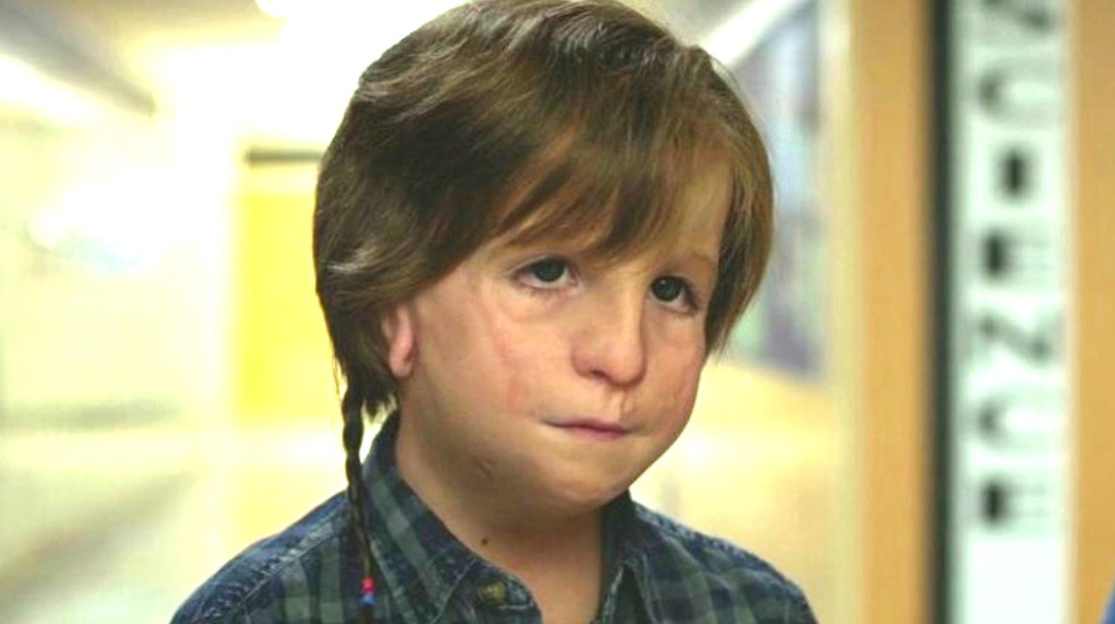 Screenshot of the film wonder, close-up of Auggie's face. Prosthetics have been used to give the actor a facial difference.